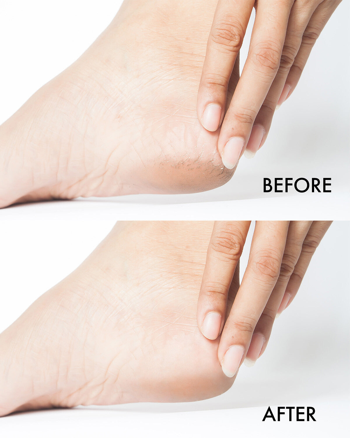 EMI Crack Treat Cream, 300 ml.