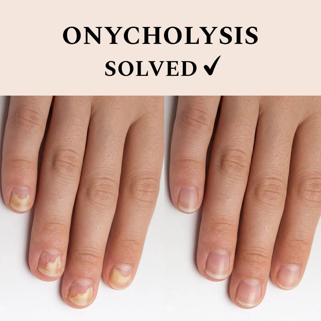 FEHU Nail Recover, 12 ml.