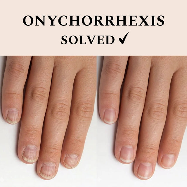 FEHU Nail Recover, 12 ml.
