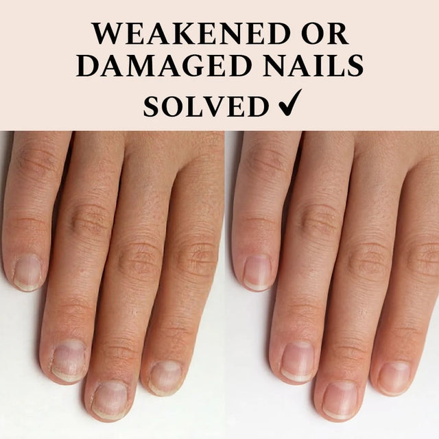 FEHU Nail Recover, 12 ml.
